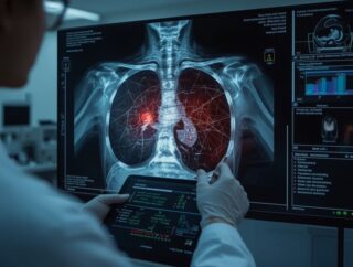 Mammografia z algorytmem w kilka minut – krótsze kolejki i szybsza diagnoza